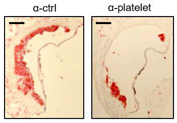 Hardening of the arteries: Platelets, inflammation and a rogue protein conspire against the heart