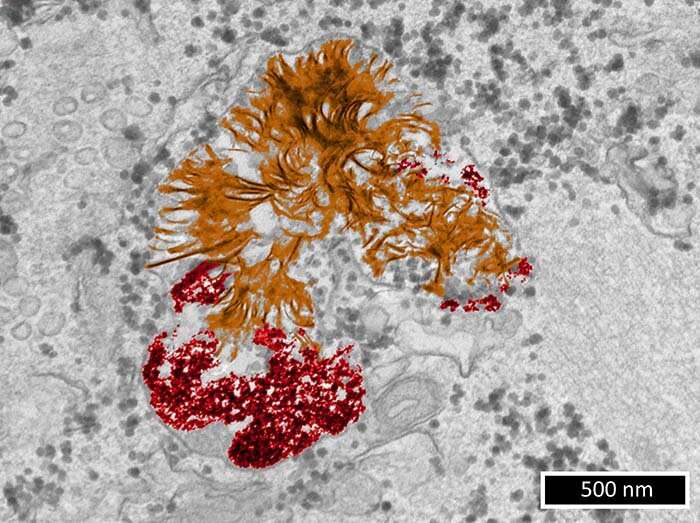 What happens to gold nanoparticles in cells?
