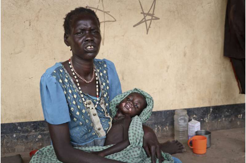 South Sudan measles outbreak raises questions about vaccines