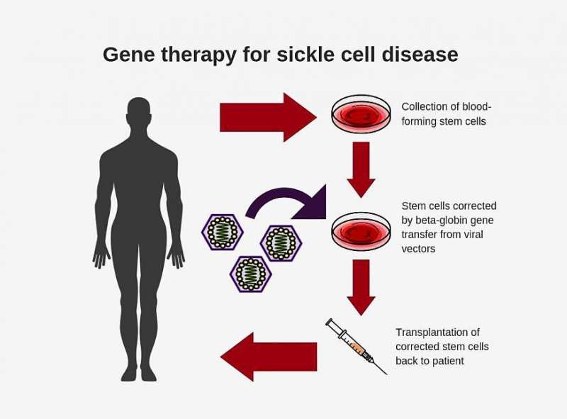 Researchers create new viral vector for improved gene therapy in sickle cell disease