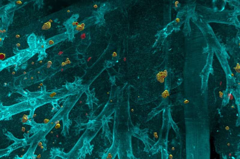 New algorithm detects even the smallest cancer metastases across the entire mous
