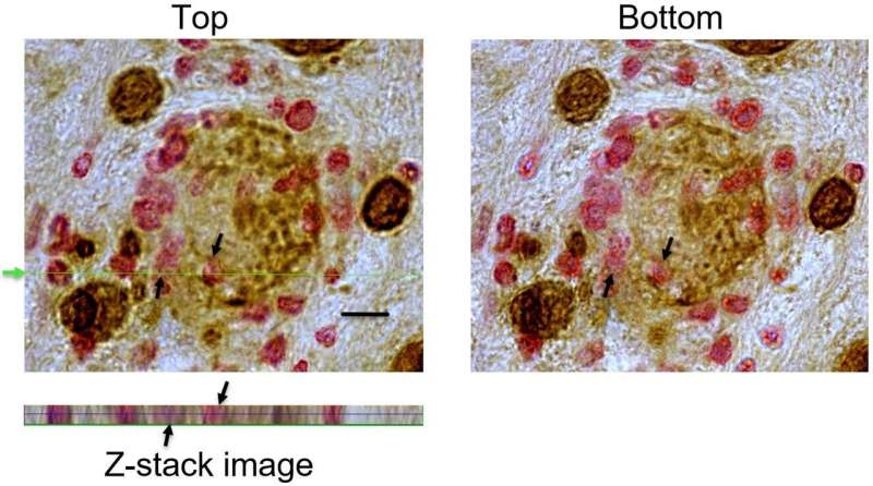 New evidence shows cytotoxic T cells can identify, invade, and destroy targets of large mass like Toxoplasma gondii tissue cysts