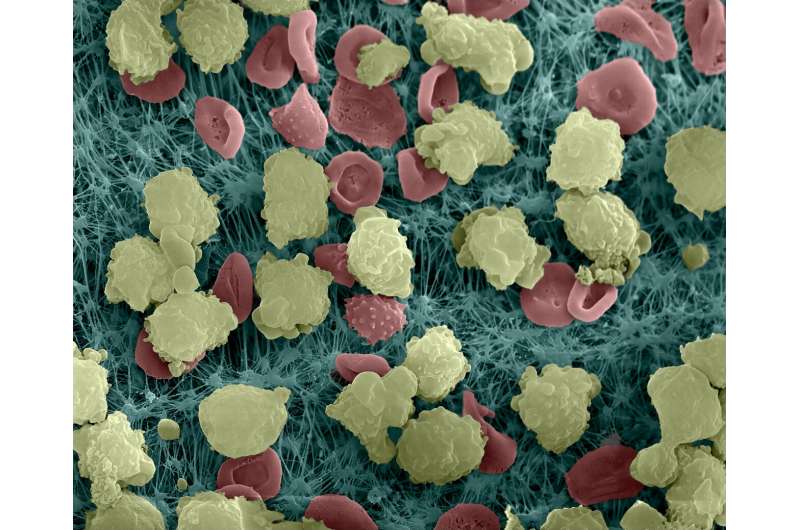 Scientists discover an immune 'clock' that controls infections and cardiovascular disease