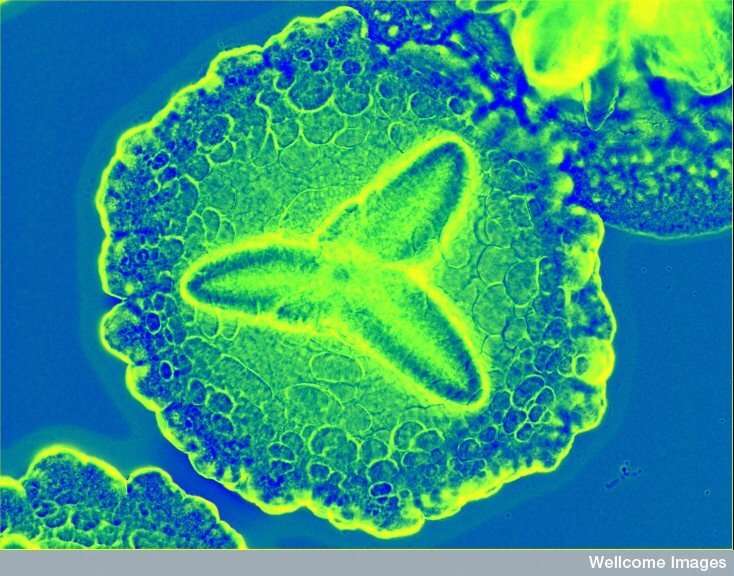 Acute periodontal disease bacteria love colon and dirt microbes