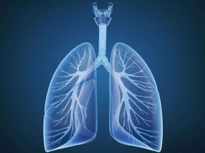 添加贝伐珠单抗可提高非小细胞肺癌的总生存率