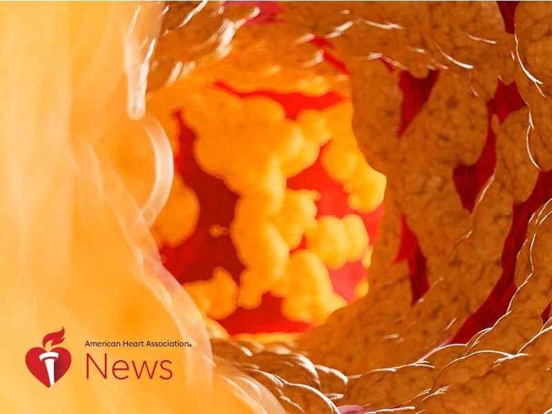 AHA news: more clues to the genetics behind an inherited cholesterol disorder