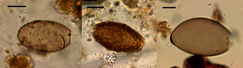 Ancient feces reveal how 'marsh diet' left Bronze Age Fen folk infected with parasites