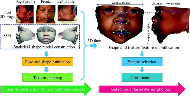 A new facial analysis method detects genetic syndromes with high precision and specificity