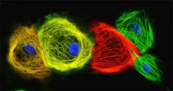 A new way to wind the development clock of cardiac muscle cells