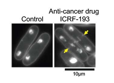 ++Anticancer mechanism revealed in yeast experiments