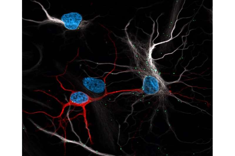 Astrocytes protect neurons from toxic buildup
