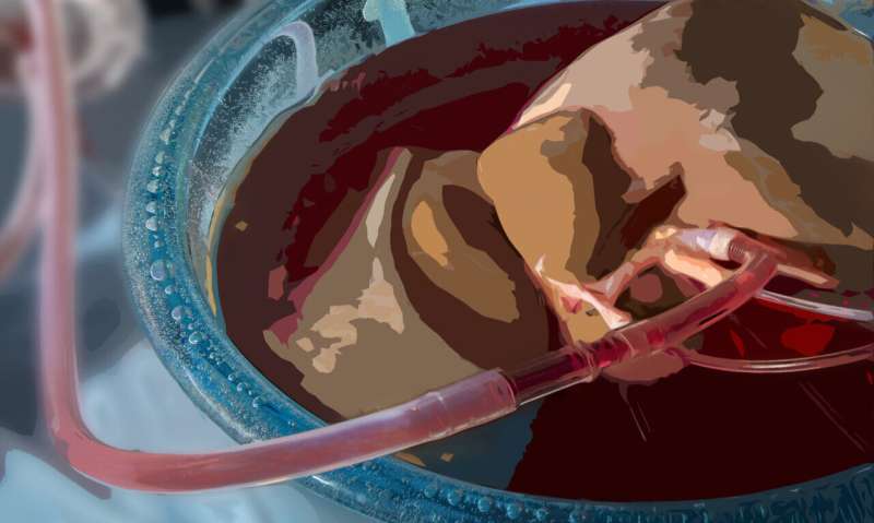 A 'super-cool' method for improving donated liver preservation