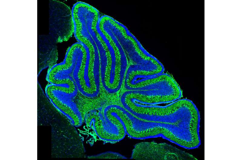 Bath scientists develop a mouse model for rare brain disease Joubert syndrome