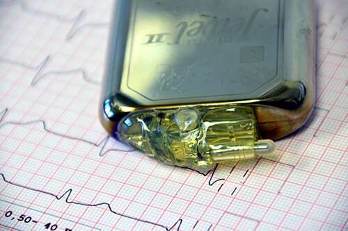 Bionic pacemaker slows progression of heart failure