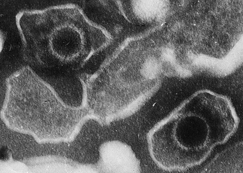 Black sheep: Why some strains of the Epstein-Barr virus cause cancer