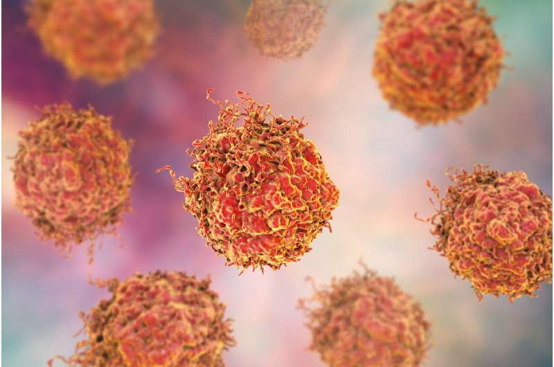 Blocking specific protein could provide new treatment for deadly form of prostate cancer