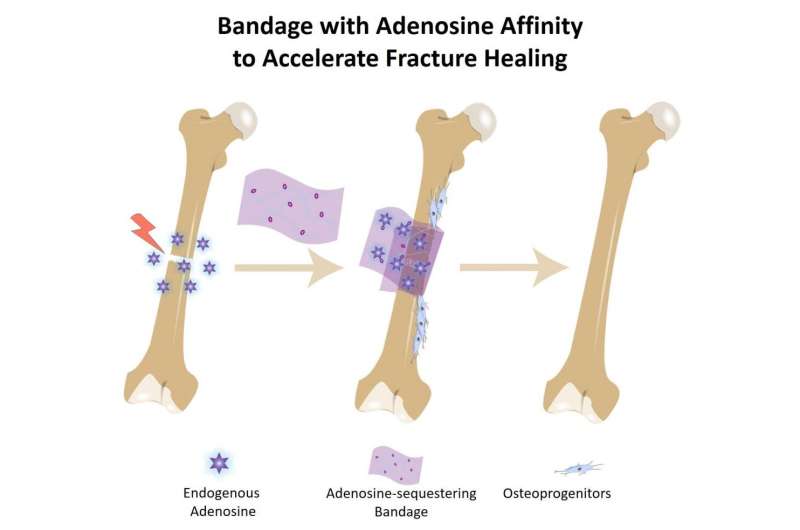 Bone bandage soaks up pro-healing biochemical to accelerate repair