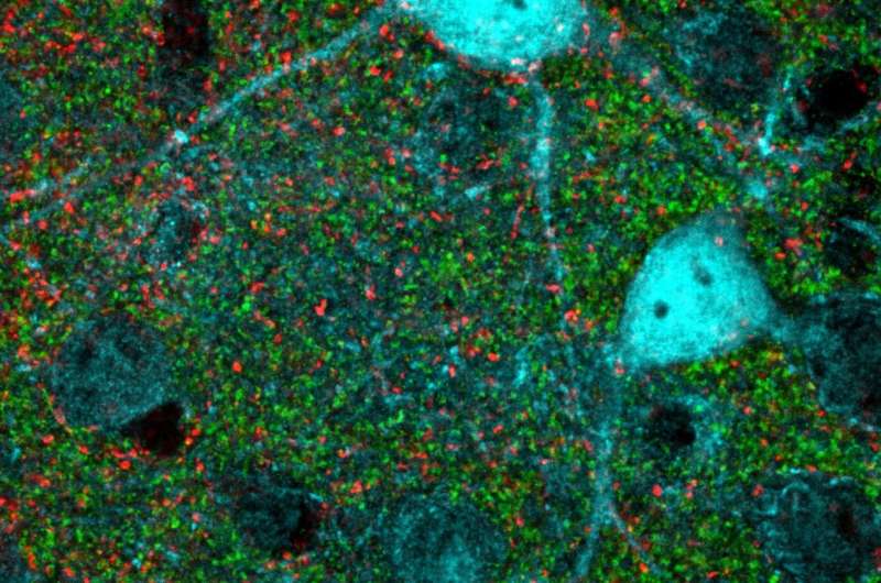 Brain plasticity restored in adult mice through targeting specific nerve cell connections