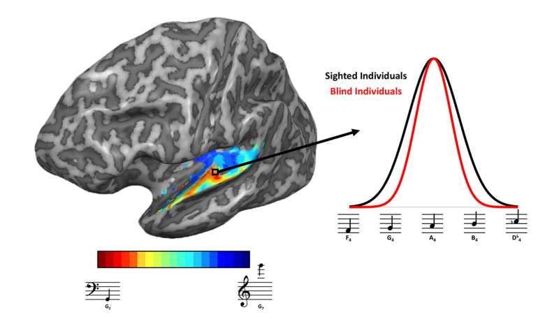 Brains of blind people adapt to sharpen sense of hearing, study shows