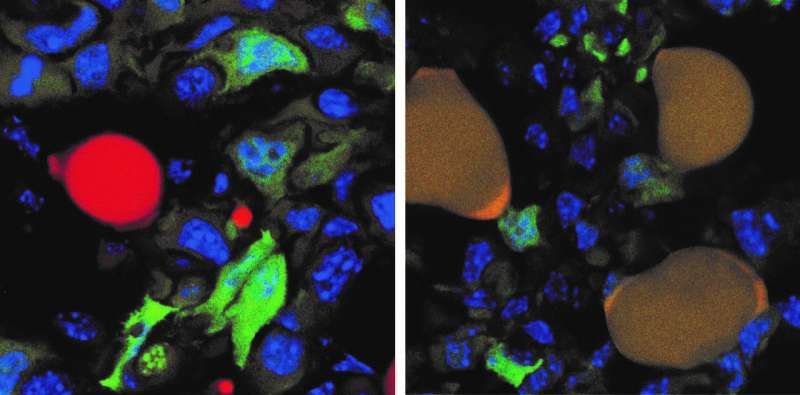Breast cancer cells in mice tricked into turning into fat cells