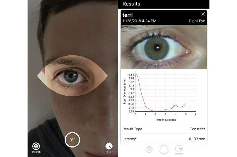 Brightlamp launches smartphone app that can rapidly monitor the brain for signs of concussion