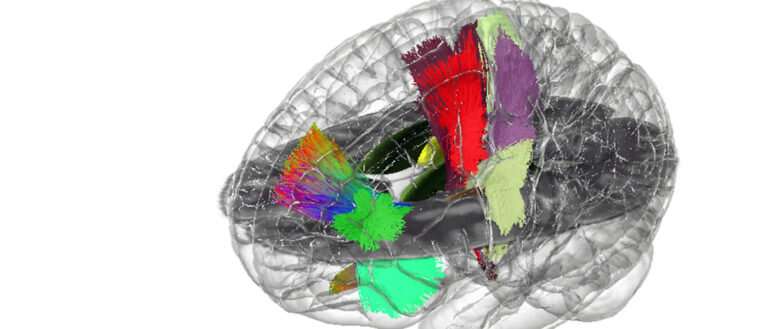 Building the first holographic brain 'atlas'