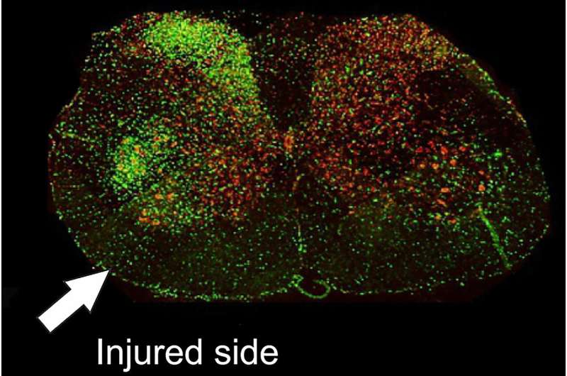 Can a nerve injury trigger ALS?