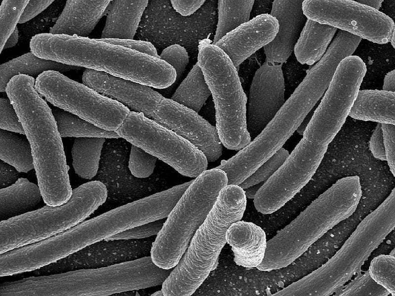 CDC investigates mystery E. coli outbreak affecting 5 states