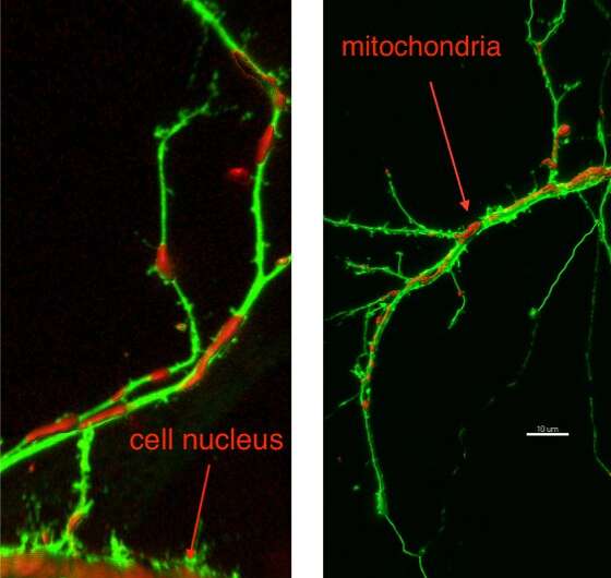Cell component breakdown suggests possible treatment for multiple neural disorders