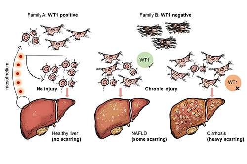 Cell family trees tracked to discover their role in tissue scarring and liver disease