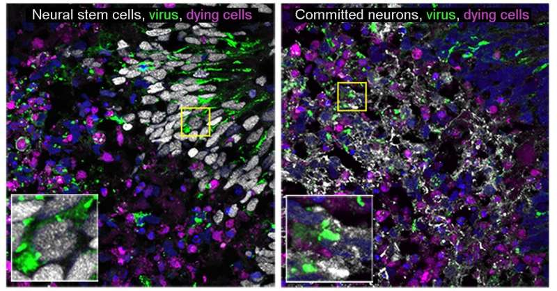 Cerebral organoid model provides clues about how to prevent virus-induced brain cell death