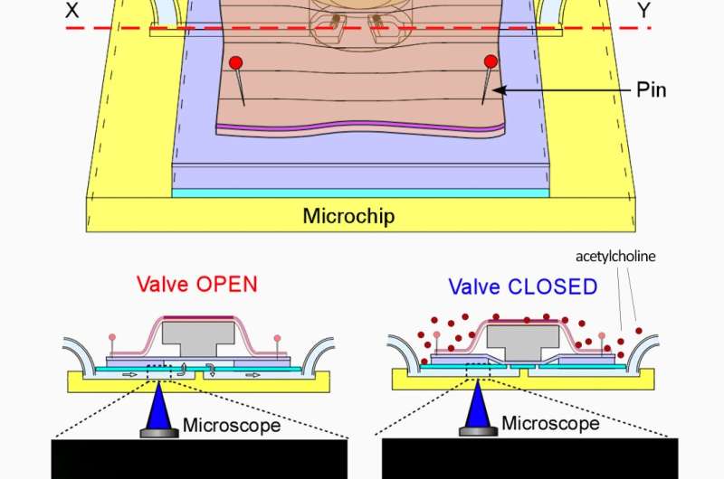 Cyborg-like microchip valve driven by earthworm muscle