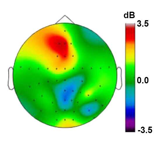 Deep stimulation improves cognitive control by augmenting brain rhythms