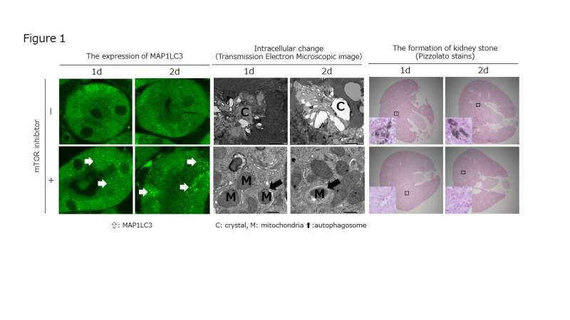 Deregulated mTOR is responsible for autophagy defects exacerbating kidney stone formation