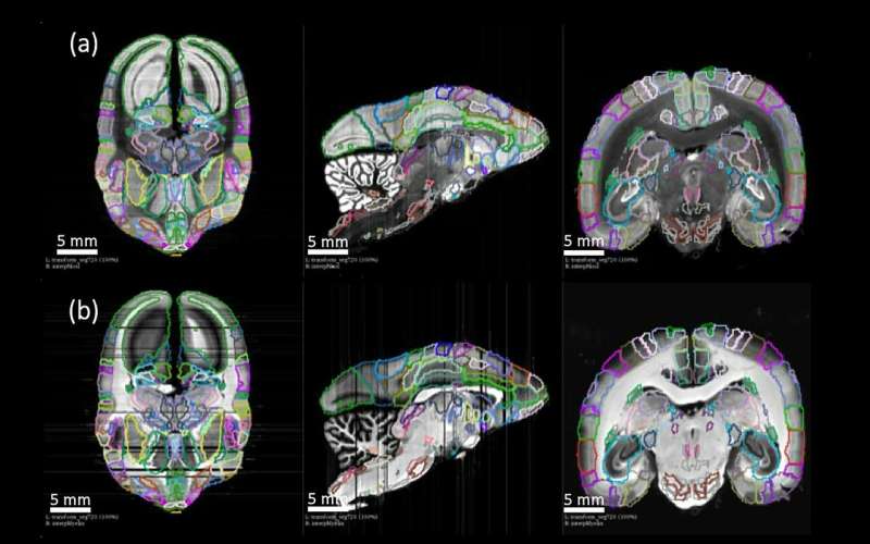 Detailed new primate brain atlas could lead to disease insights