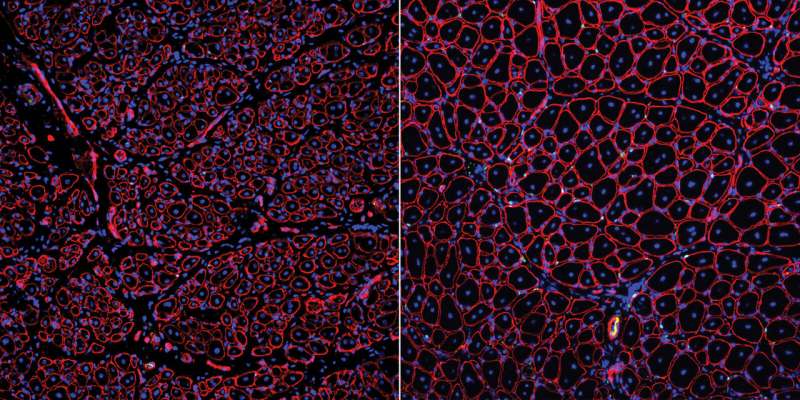 Discovered: Possible therapeutic target for slow healing of aged muscles