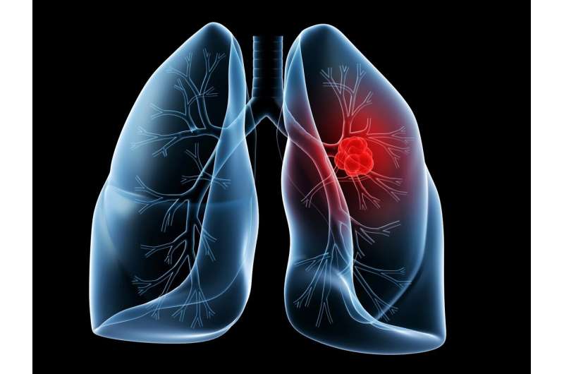 Discovery of distinct lung cancer pathways may lead to more targeted treatments
