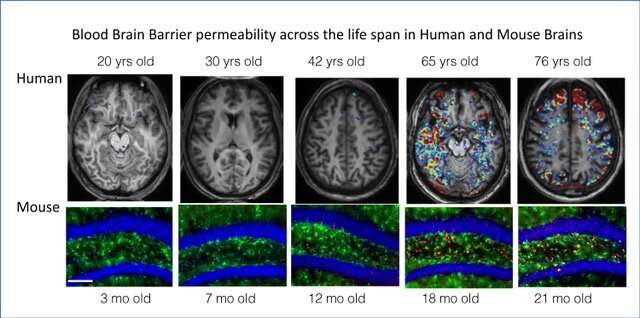 Drugs that quell brain inflammation reverse dementia