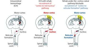 Dynamic reorganization of brain circuit with post-stroke rehabilitation