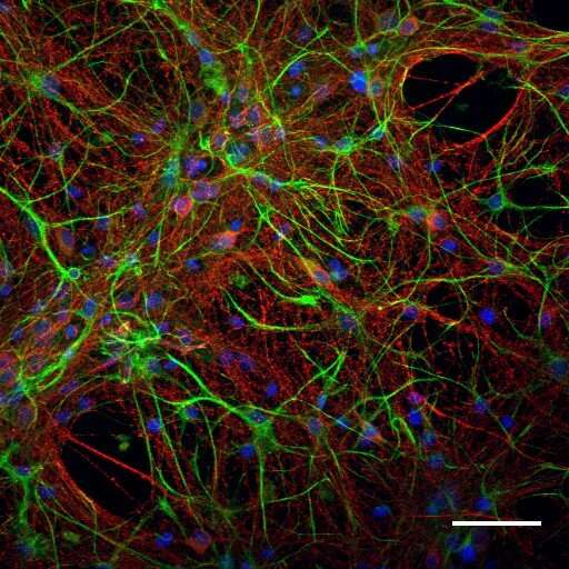 Efficient, interconnected, stable: New carbon nanotubes to grow neurons