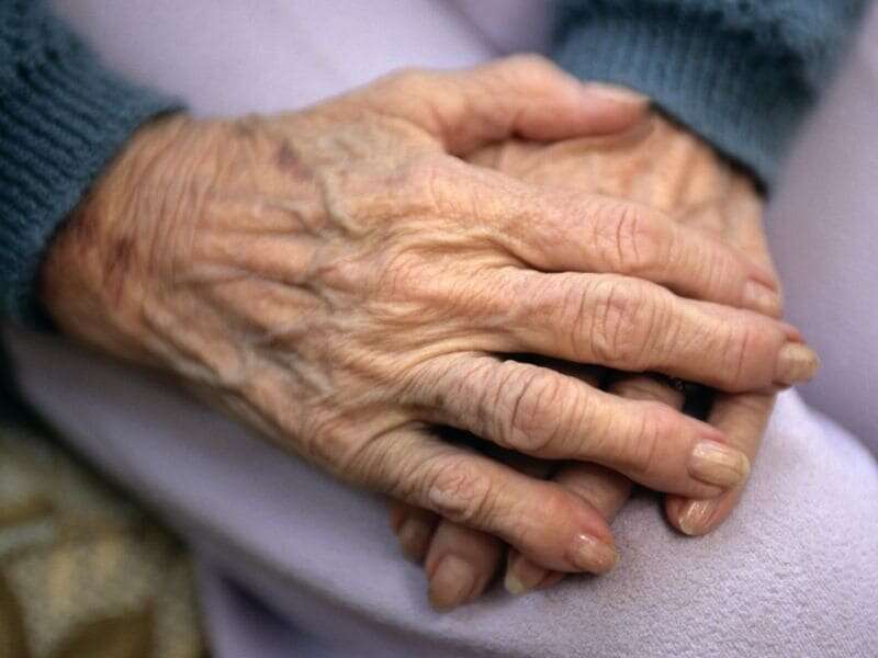 Elderly-onset rheumatoid arthritis ups bone erosion risk
