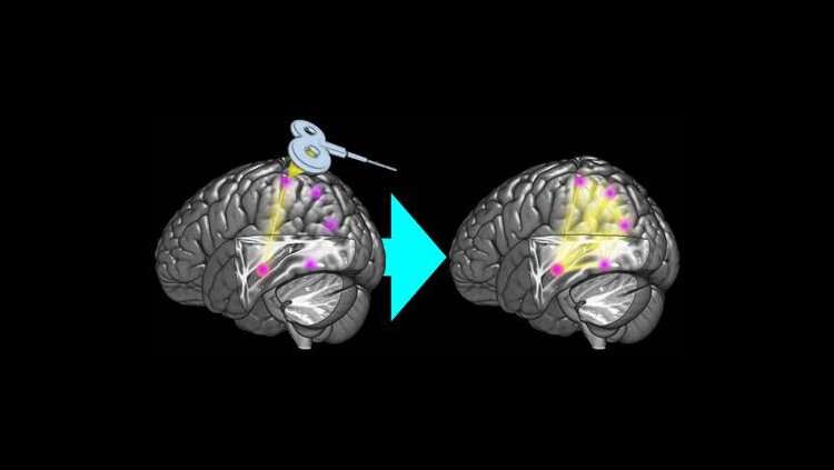 Enhancing memory network via brain stimulation
