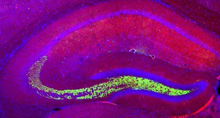 Exercise fine-tunes brain's connections, eases autism spectrum disorder in mouse model