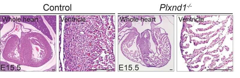 Faulty signalling pathway linked to congenital heart condition