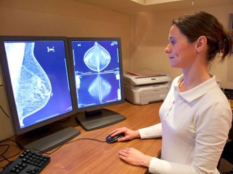 Fewer interval cancers diagnosed with supplemental MRI for dense breasts