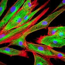 Fibroblasts involved in healing spur tumor growth in cancer