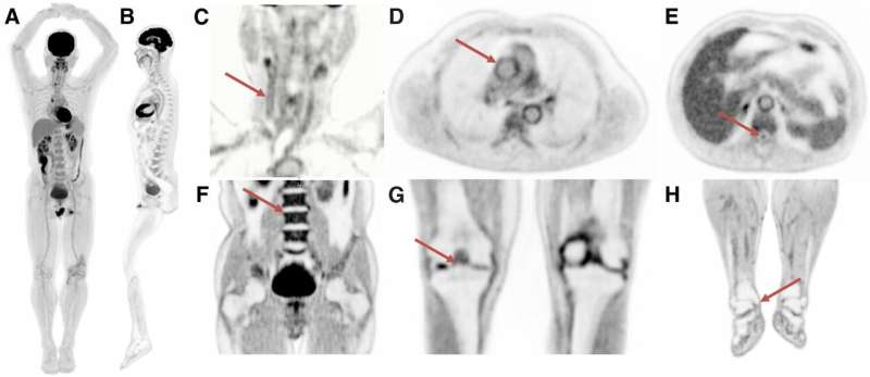 First total-body PET/CT studies show potential for better, faster, lower-dose images