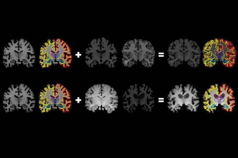 From one brain scan, more information for medical artificial intelligence