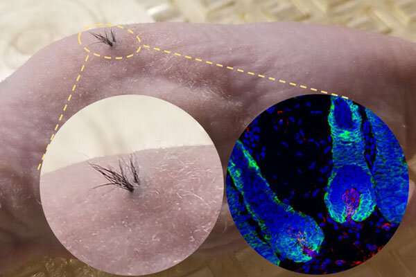 Functional hair follicles grown from stem cells