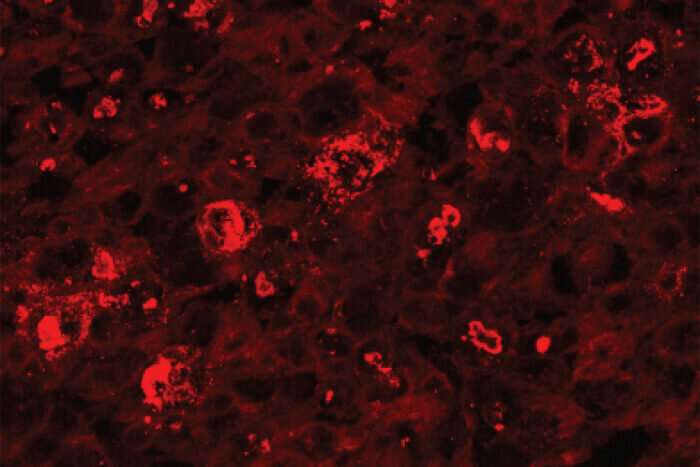 Gene therapy blocks peripheral nerve damage in mice